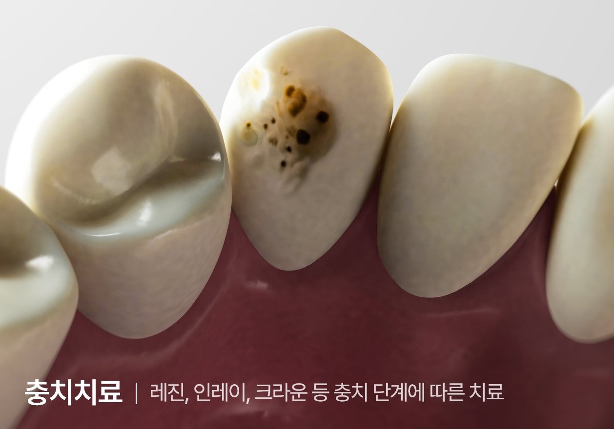 통합치의학과 전문의 대표원장이 직접 진료합니다.