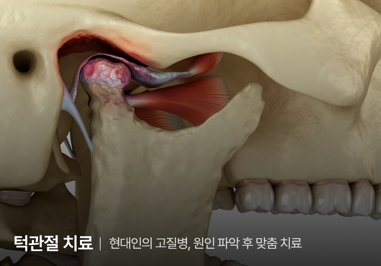 통합치의학과 전문의 대표원장이 직접 진료합니다.